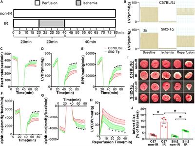 Slit2 Protects Hearts Against Ischemia-Reperfusion Injury by Inhibiting Inflammatory Responses and Maintaining Myofilament Contractile Properties